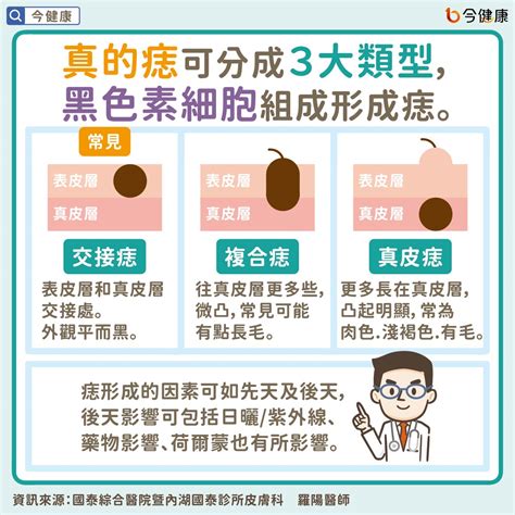 為何會長痣|是痣？皮膚癌？還是什麼？常見Q&A解惑！醫教揪出「。